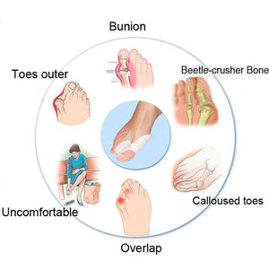 BUNION TOE CORRECTOR